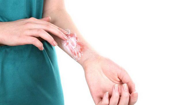 5 Mitos Tentang Luka yang Masih Dipercaya Banyak Orang, Kamu Termasuk?