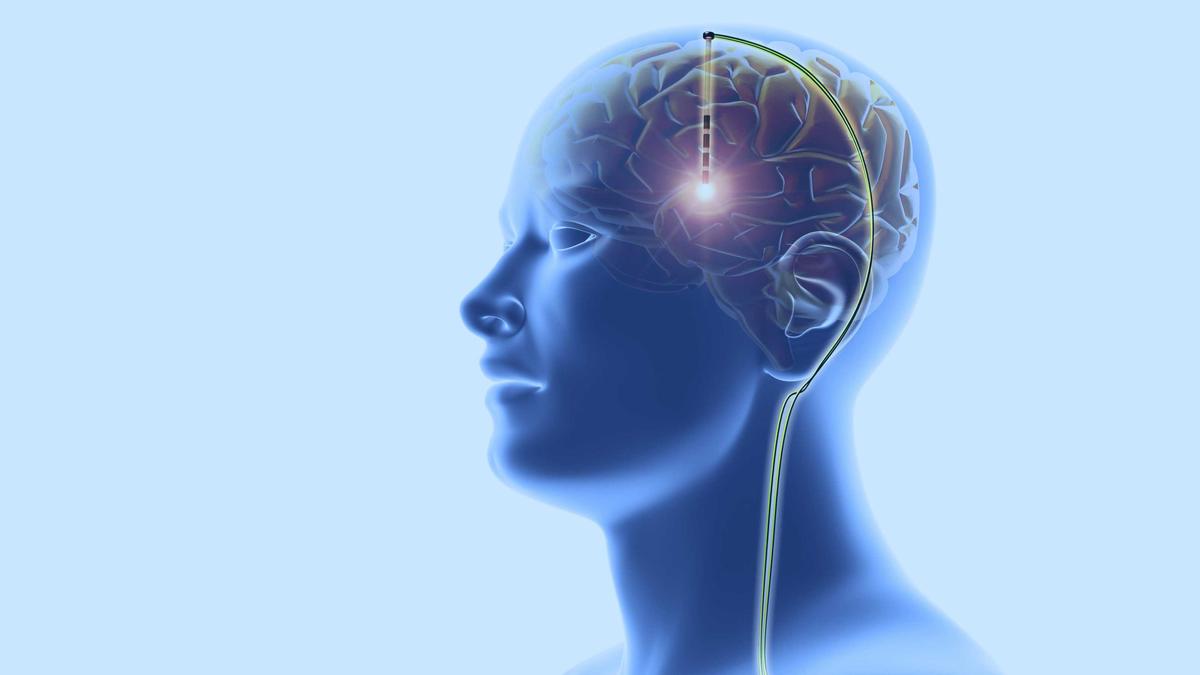 Fakta Membuktikan, Otak Manusia Ternyata Semakin Menyusut