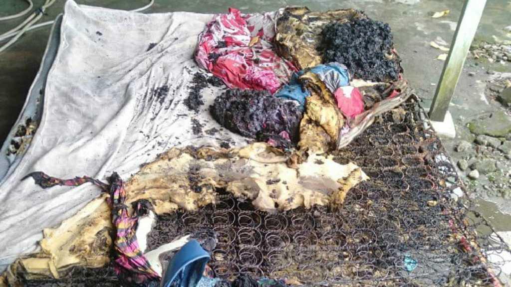 Diduga Akibat AC Korsleting, Bocah di Medan Ditemukan Terbakar Dalam Kamar