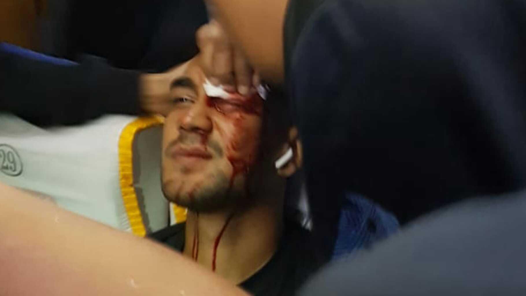Dua Pemain Terluka Usai Bus Persib Ditimpuk Batu, Begini Ciri-ciri Pelaku