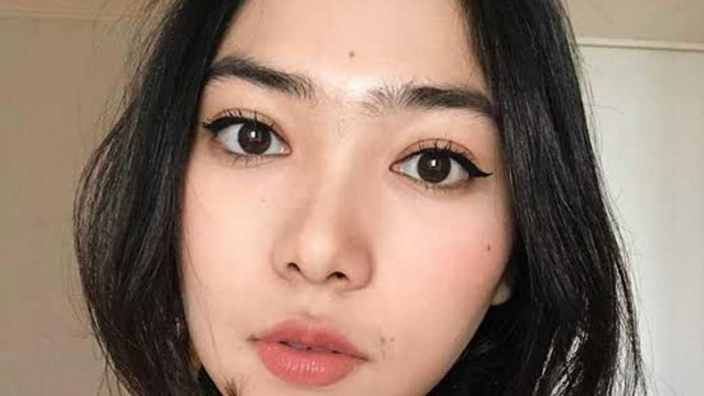 Yuk Kenali Posisi Tahi Lalat, Ternyata Bisa Lambangkan Kebaikan Lho!