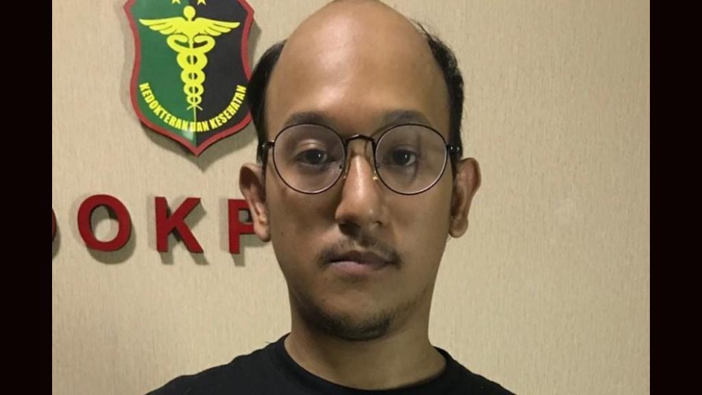 Artis Lenong Rivat Umar Positif Konsumsi Ganja dan Sabu-sabu