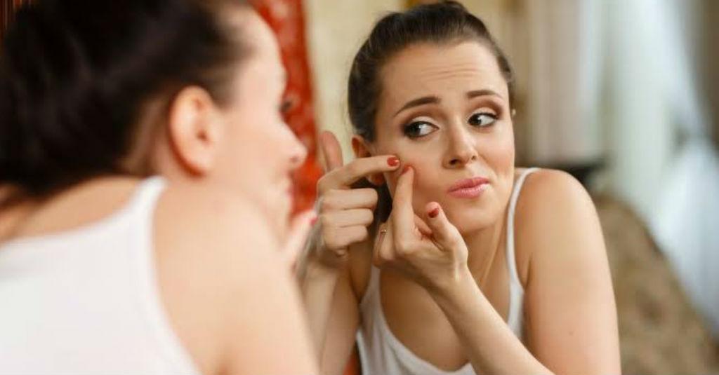 Frustrasi dengan Jerawat? Ini 7 Tips Mudah Menghilangkannya