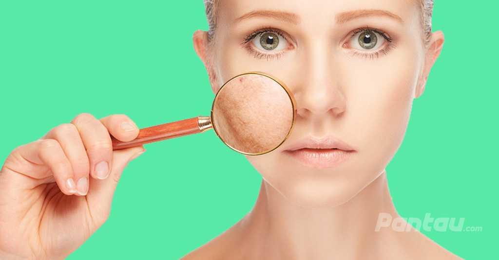 Kadar Gula Darah Tinggi Bikin Wajah Terlihat Lebih Tua