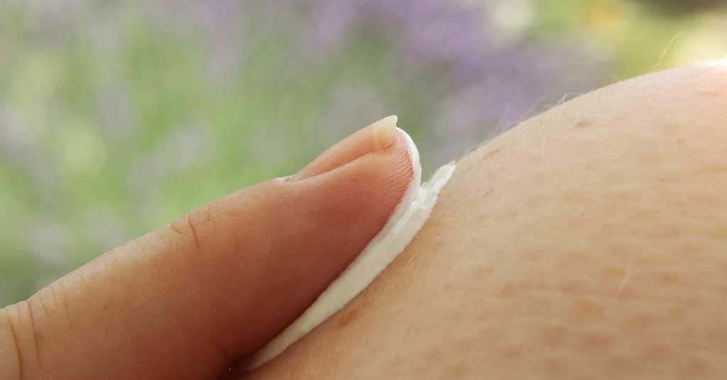 Tak Bisa Sembuh, Begini Cara Merawat Kulit Dermatitis Atopik