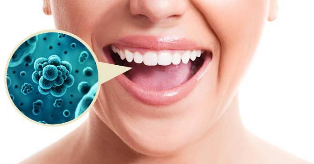 5 Masalah Kesehatan Mulut yang Tidak Anda Ketahui