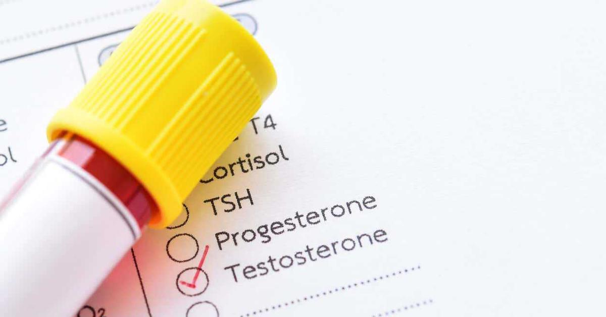 Benarkah Hormon Testosteron Bisa Kurangi Risiko Stroke?