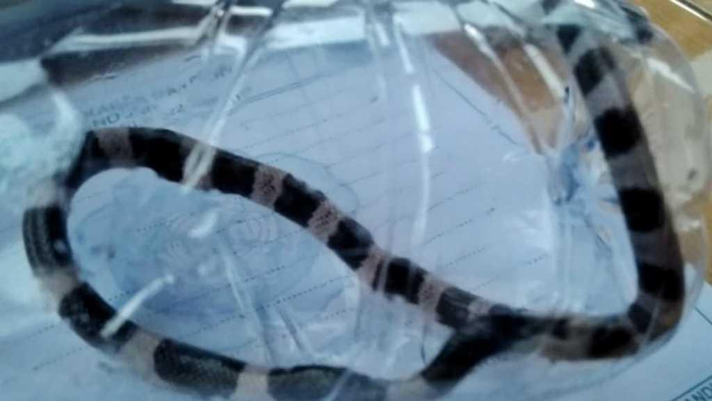 Bocah 11 Tahun Tewas Dipatuk Ular Weling Pemberian Orang Tak Dikenal