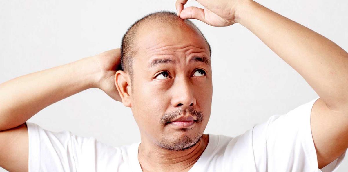 6 Faktor yang Mempengaruhi Rambut Menjadi Sulit Tumbuh