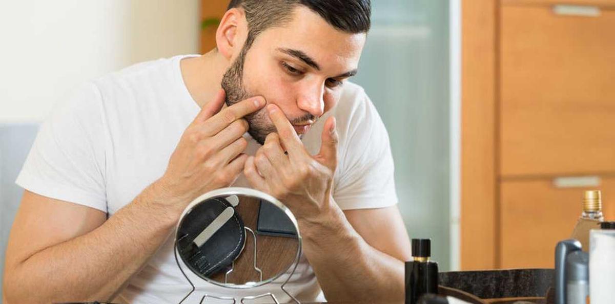 7 Obat Rumahan yang Ampuh Mengatasi Jerawat Membandel pada Pria