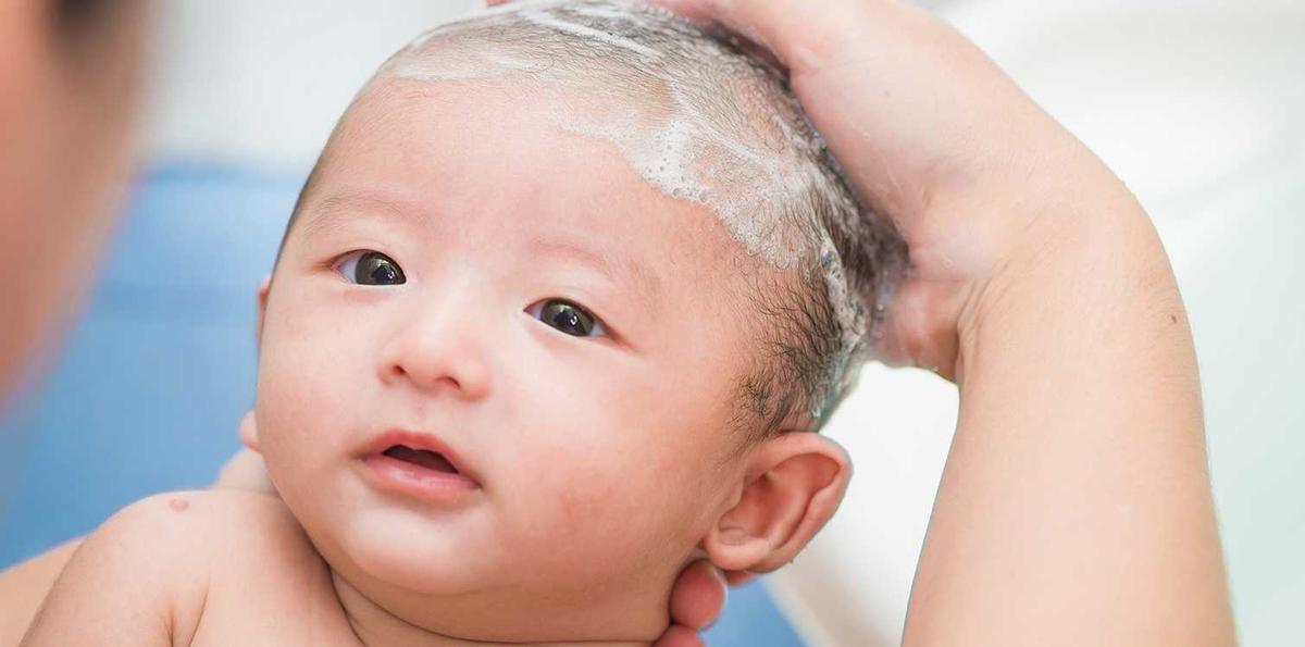 Begini 5 Cara Mudah Mengatasi 'Cradle Cap' alias Ketombe pada Bayi