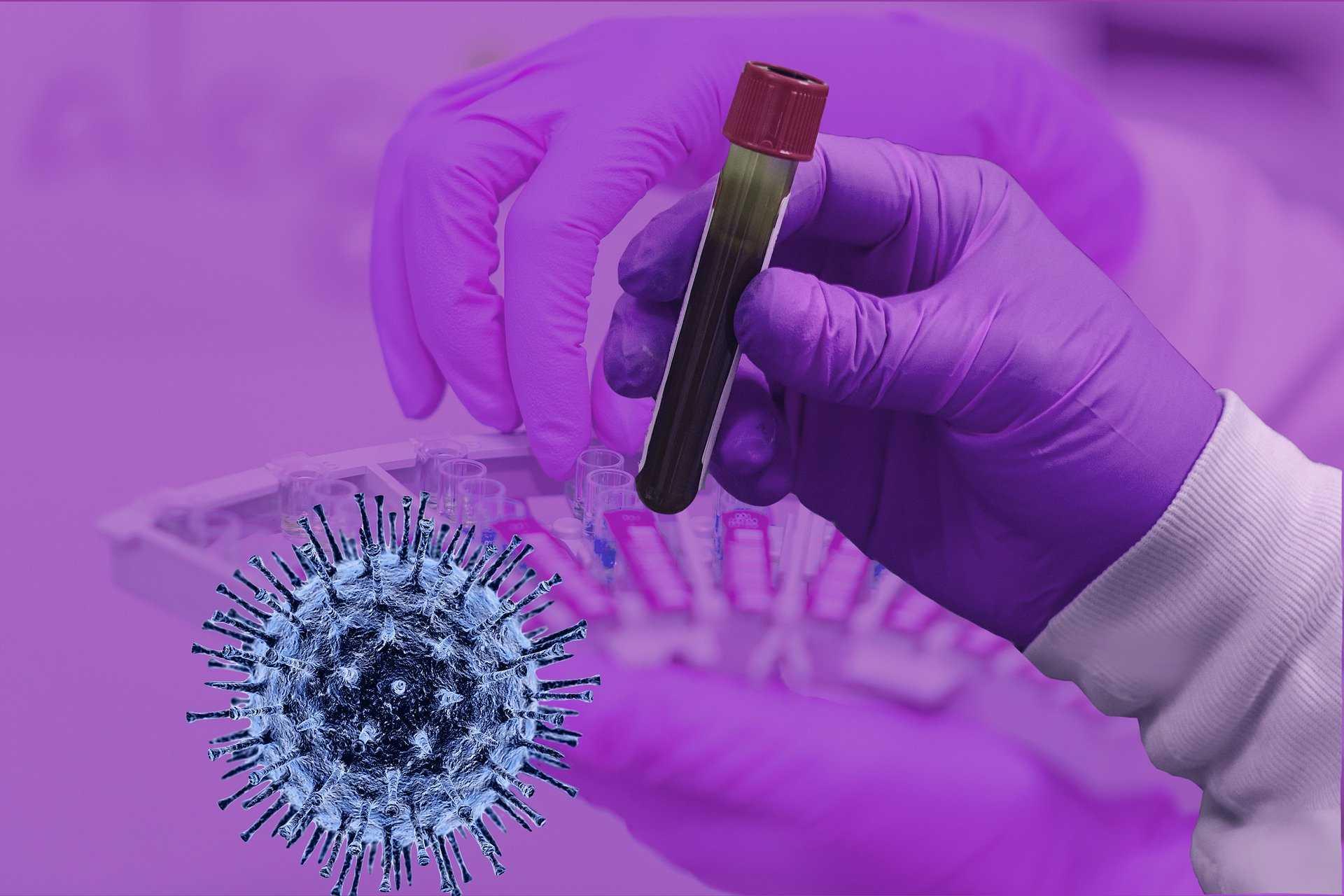 Abbott Laboratories Klaim Miliki Alat Tes Deteksi Korona Tercepat
