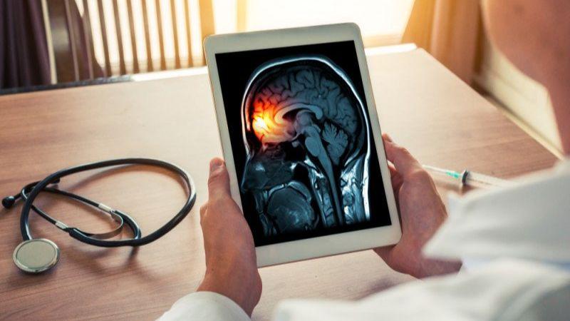 Dokter Spesialis Sebut Cara Ini Bisa Cegah Meningitis