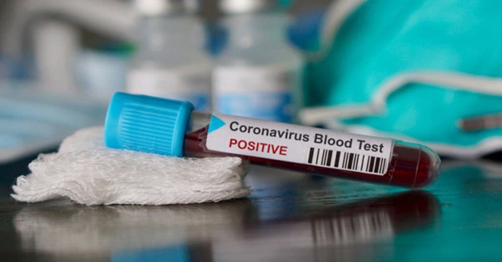 Pasien Sembuh Tembus 1.000 Jiwa, Kasus Positif Korona di Indonesia 8.211