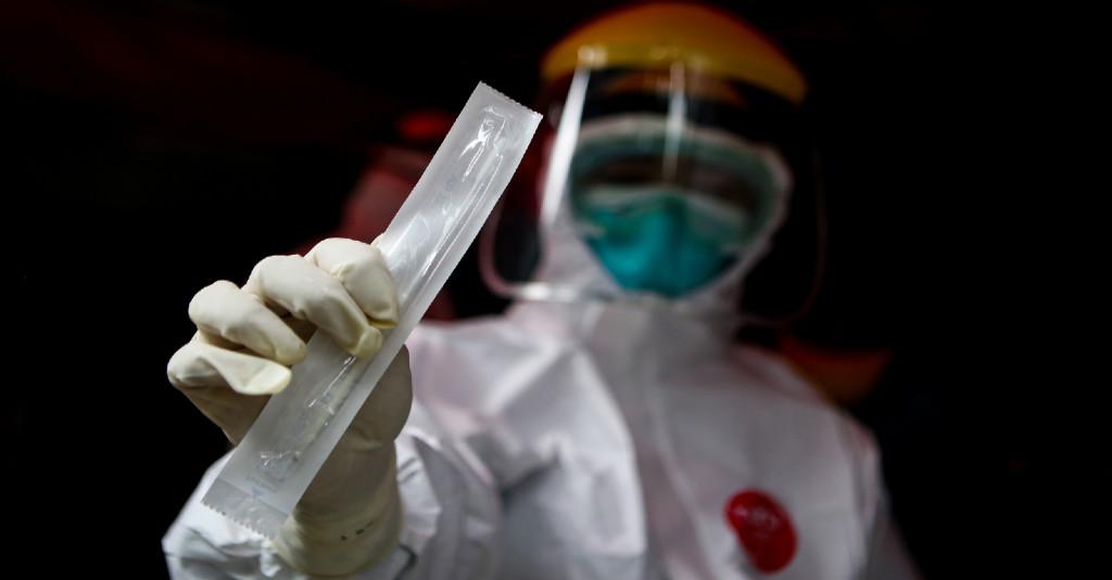 Dokter Paru: Ada Hasil Negatif Palsu COVID-19 pada Test PCR