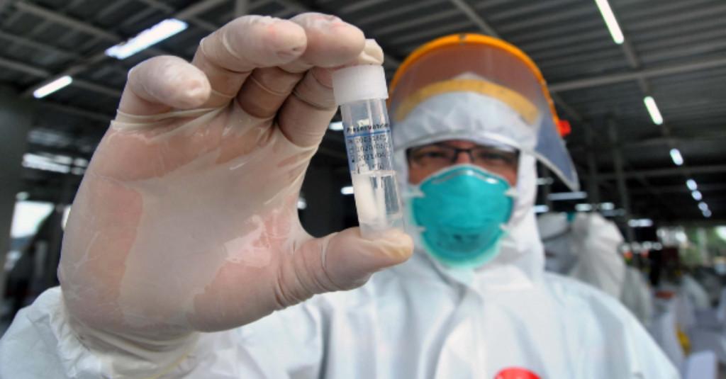 Gugus Tugas Waspadai Hasil Test Swab Negatif Palsu Pemicu Reinfeksi Korona