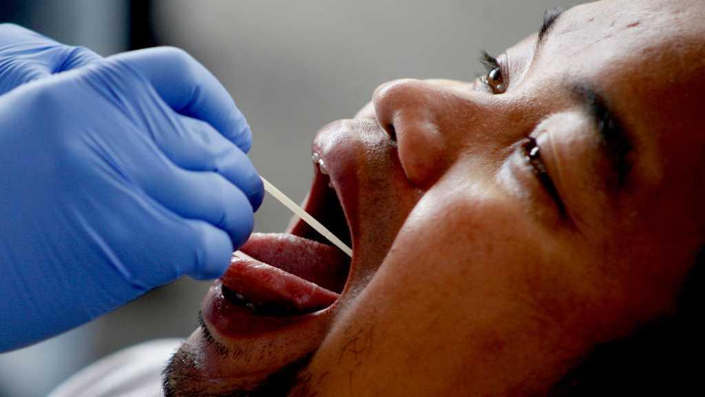 Dokter Spesialis Paru: PCR dan Rapid Test Saling Melengkapi untuk COVID-19