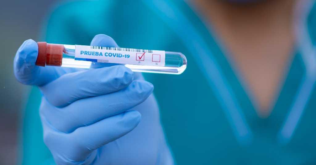 Kasus Positif COVID-19 di Papua Barat Bertambah 14 Orang