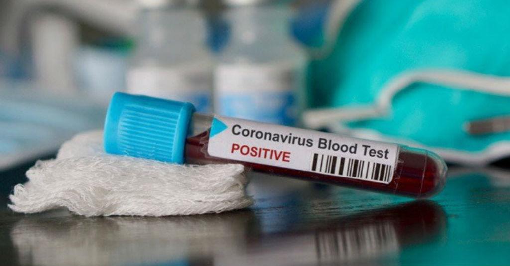 Hasil Rapid Test Hari Ini, Seorang Pedagang Pasar Klender Reaktif COVID-19