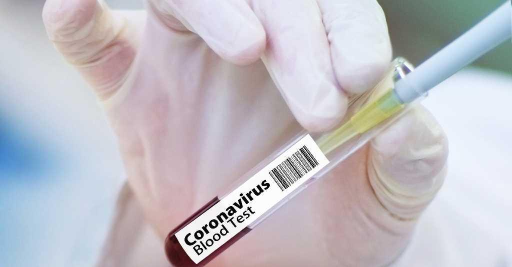 Riset di Wuhan: Obat Tekanan Darah Tinggi Mampu Lindungi Pasien COVID-19