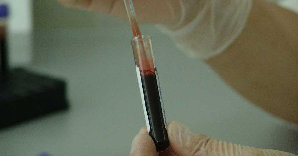 Punya Gejala Sama, Ini Perbedaan COVID-19 dan Lyme