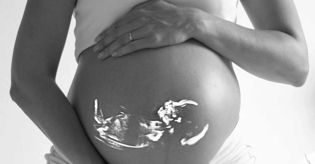 Angka Kehamilan di Padang Masih Aman Selama Pandemi COVID-19