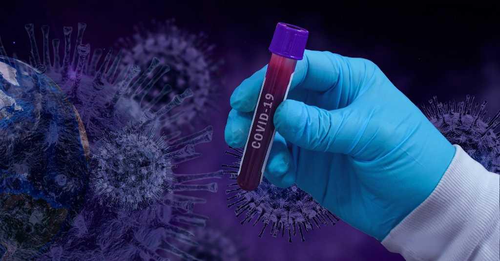 Ada Tudingan Dokter Ditekan Kepala Daerah untuk Kurangi Tes PCR, Benarkah?