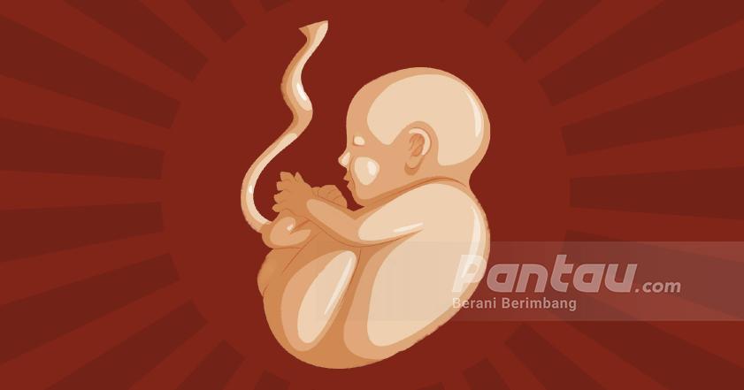 IDI Ungkap RUU Kesehatan Omnibus Law Bolehkan Aborsi hingga Usia Kehamilan 14 Minggu