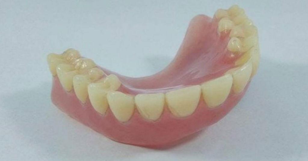 Begini Lho Cara Merawat Gigi Palsu Biar Awet dan Sehat
