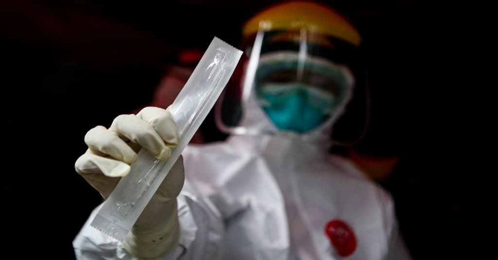 BPKP Usul Swab Test Mandiri Rp797.000, Begini Respons Doni Monardo