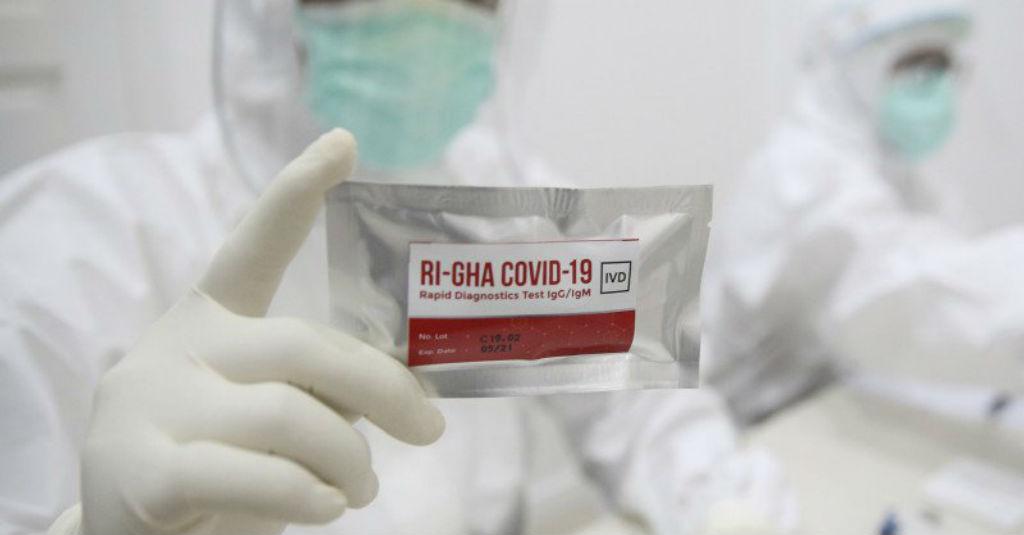 Indofarma Dukung Pengadaan Tes Antigen Gantikan Rapid Test