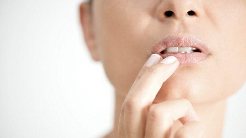 Benarkah Sariawan Dapat Menular? Begini Jawaban Dokter