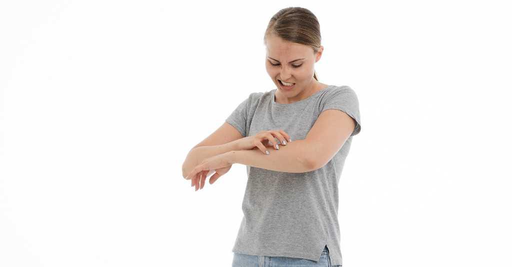 Kerap Terabaikan, Psoriasis Bisa Berkembang Menjadi Penyakit Serius