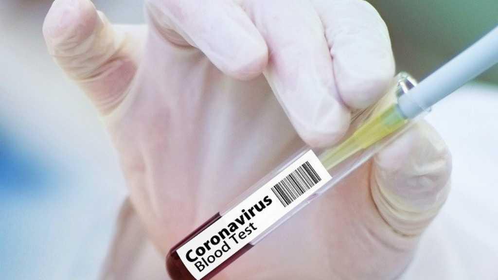 Remdesivir Tidak Terbukti Selamatkan Nyawa Pasien COVID-19