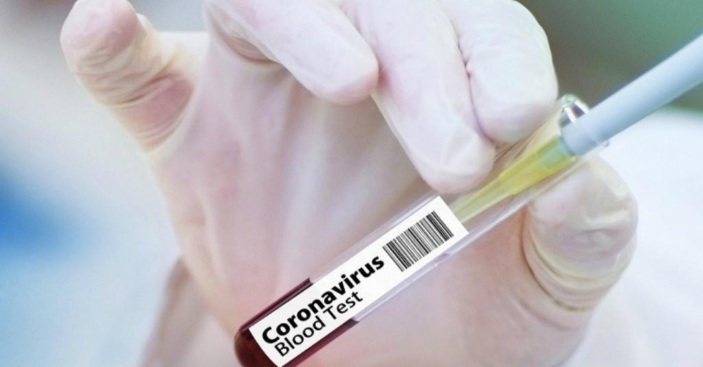 OTG Jadi Sumber Penyebaran COVID-19 Terbesar