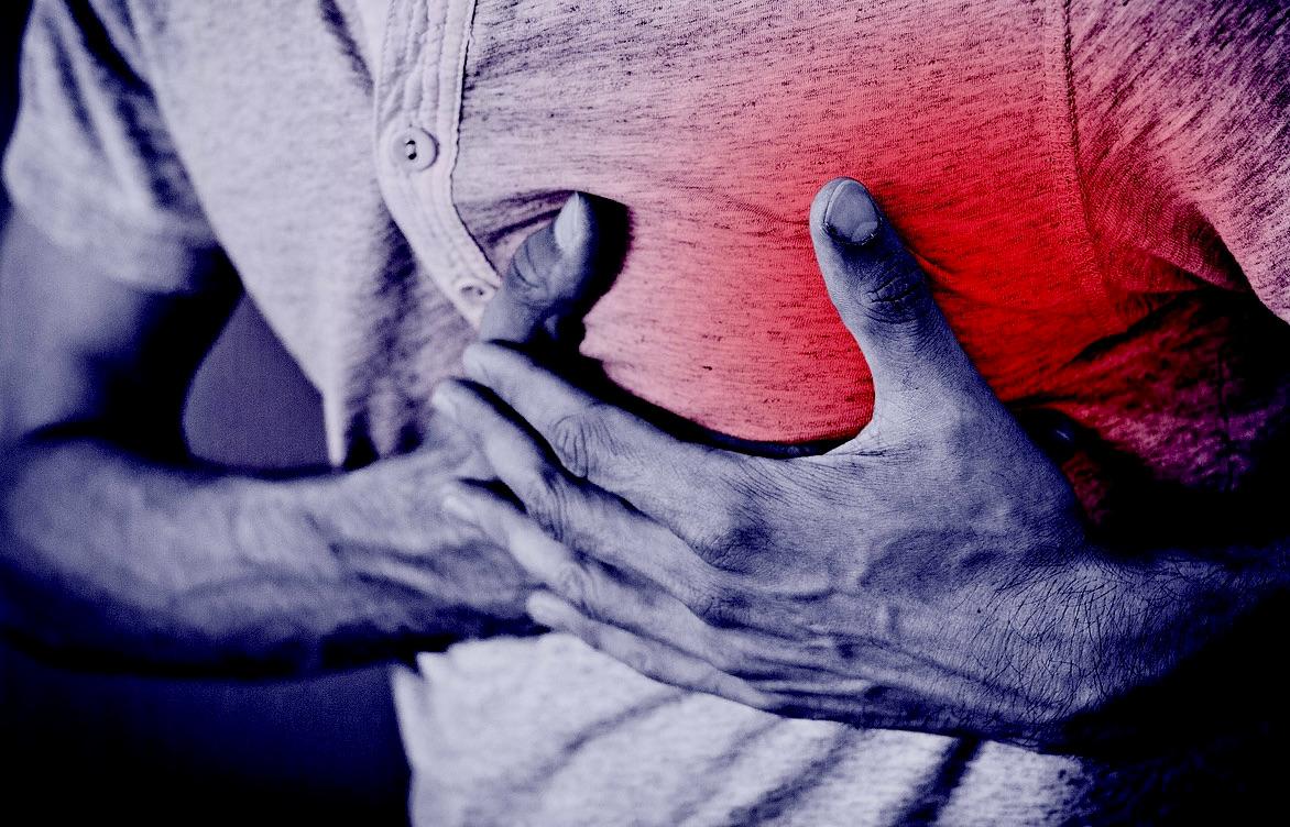 Ahli Kesehatan : Jenis Penyakit Jantung Ini Bisa Muncul karena Polusi Udara