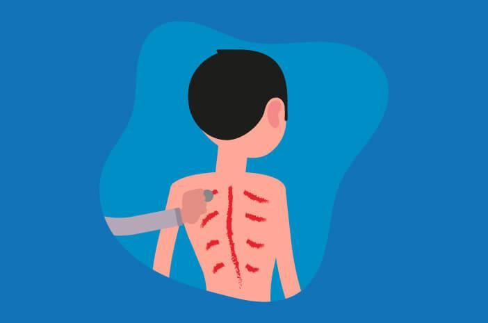 Viral Kulit Balita Dikerok! Ini Kata Dokter