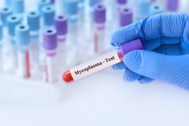 Sebanyak 2.310 Balita di Jakarta Pusat Terinfeksi Mycoplasma Pneumonia