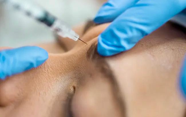 Baby Botox, Tren Suntik Anti-penuaan di Kalangan Gen-Z
