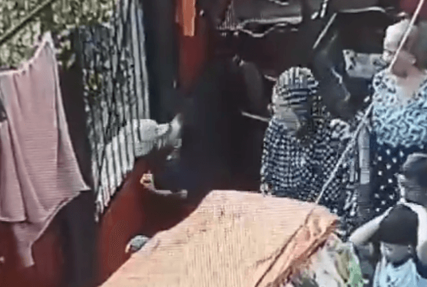 Viral Wajah Bocah 7 Tahun di Jaksel Digigit Anjing Tetangga hingga Mata Terluka