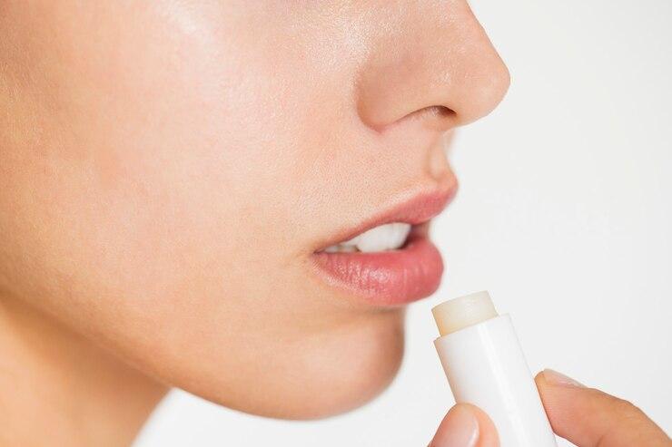 Ini Penyebab Bibir Pecah-pecah dan Cara Mengatasinya