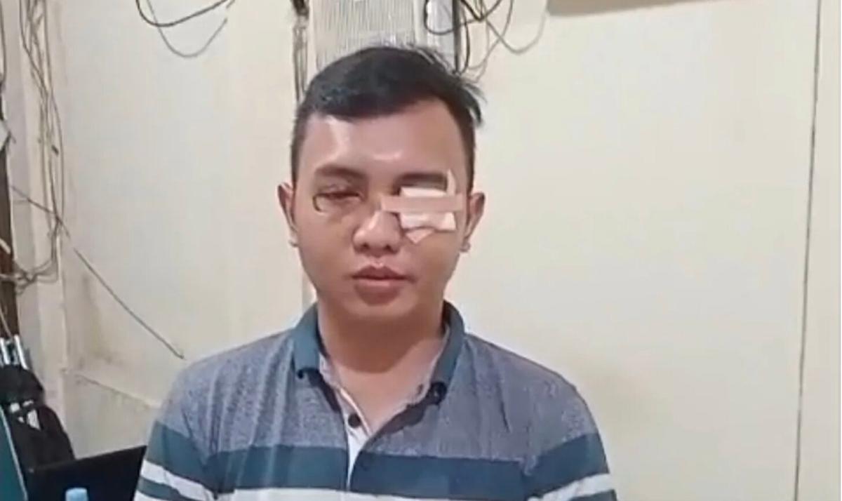 Anak PNS Kemhan yang Terlibat Kecelakaan di Jakbar Minta Maaf ke Keluarga Korban