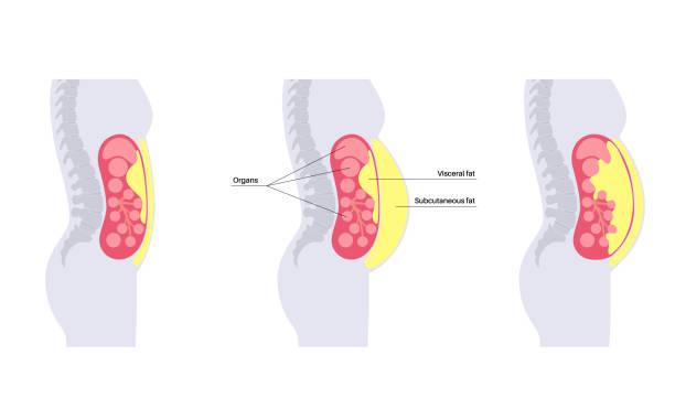 Sering Disepelekan, Ini Penyebab Lemak Menumpuk di Perut Bawah
