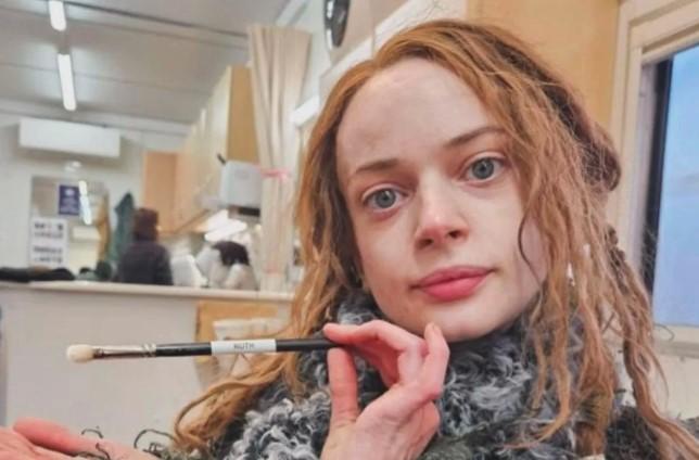 Ruth Codd Jalani Amputasi Kedua, Ungkap Perjuangan dengan Disabilitas dan Nyeri Kronis