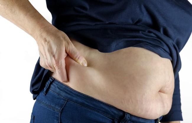 Dokter Ungkap Wanita Lebih Rentan Mengalami Perlemakan Hati Setelah Usia 45 Tahun