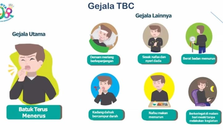Dokter Ingatkan Batuk Lebih dari Dua Pekan Bisa Jadi Gejala TBC, Waspadai Keringat Malam dan Berat Badan Turun