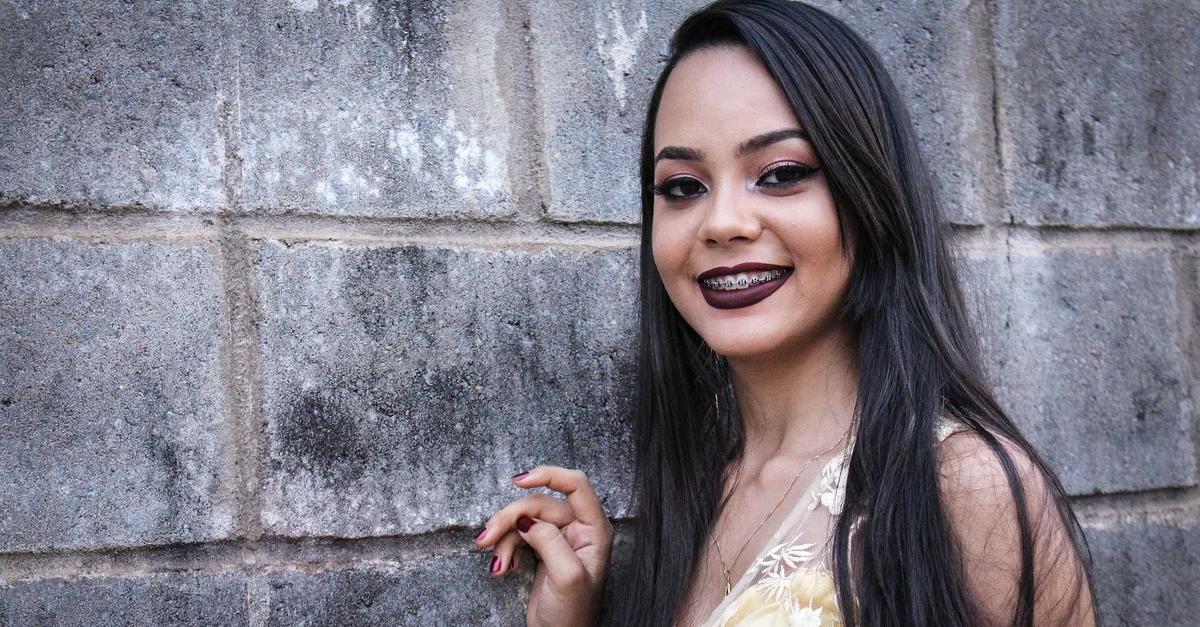 Penggunaan Behel Terlalu Lama Bisa Picu Masalah Gigi