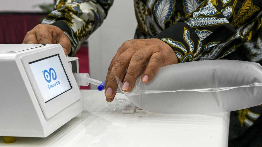 GeNose UGM Mampu Lakukan 100 Ribu Kali Test untuk Skrining COVID-19