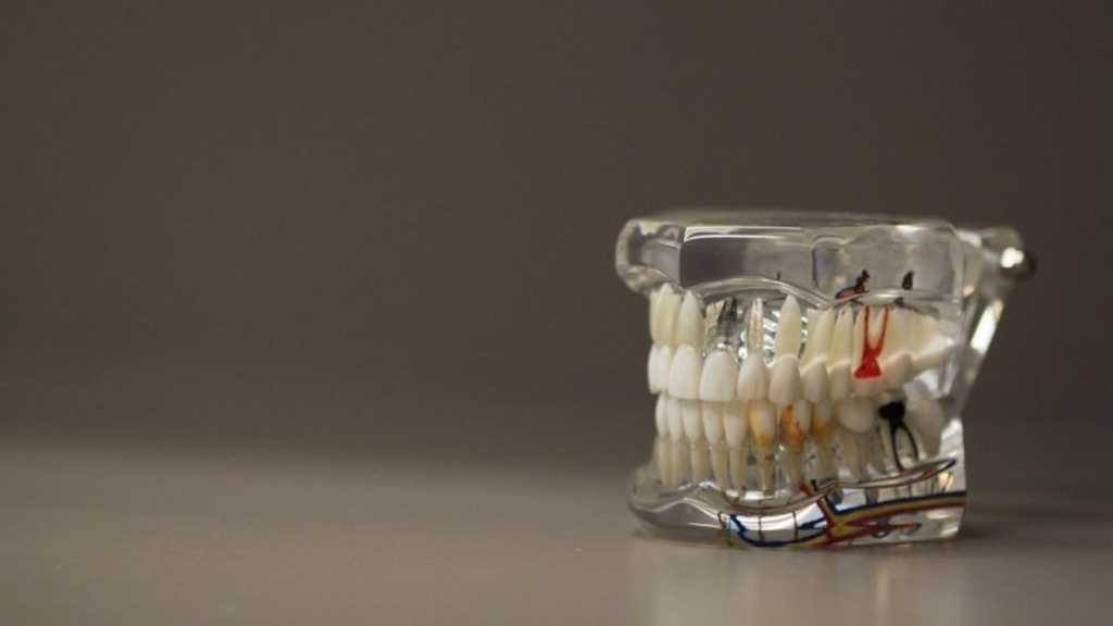 Stres Bisa Picu Bruxism, Kebiasaan Buruk Menggemertakkan Gigi