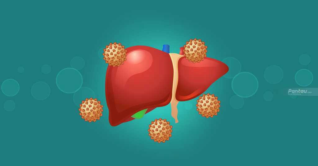 Kemenkes Cegah Penularan Dini 18 Juta Kasus Hepatitis